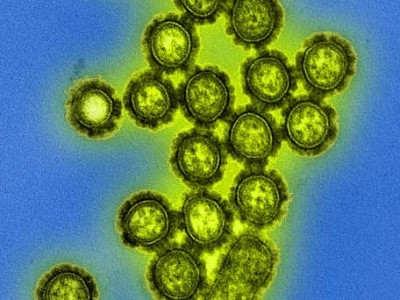 Norovirus